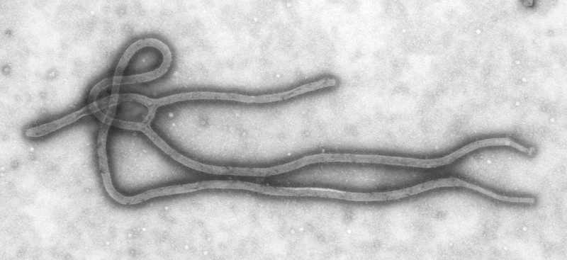 Electron microscope image of Ebola virus particles — Kenya confirmed its first Ebola case, the Bundibugyo strain