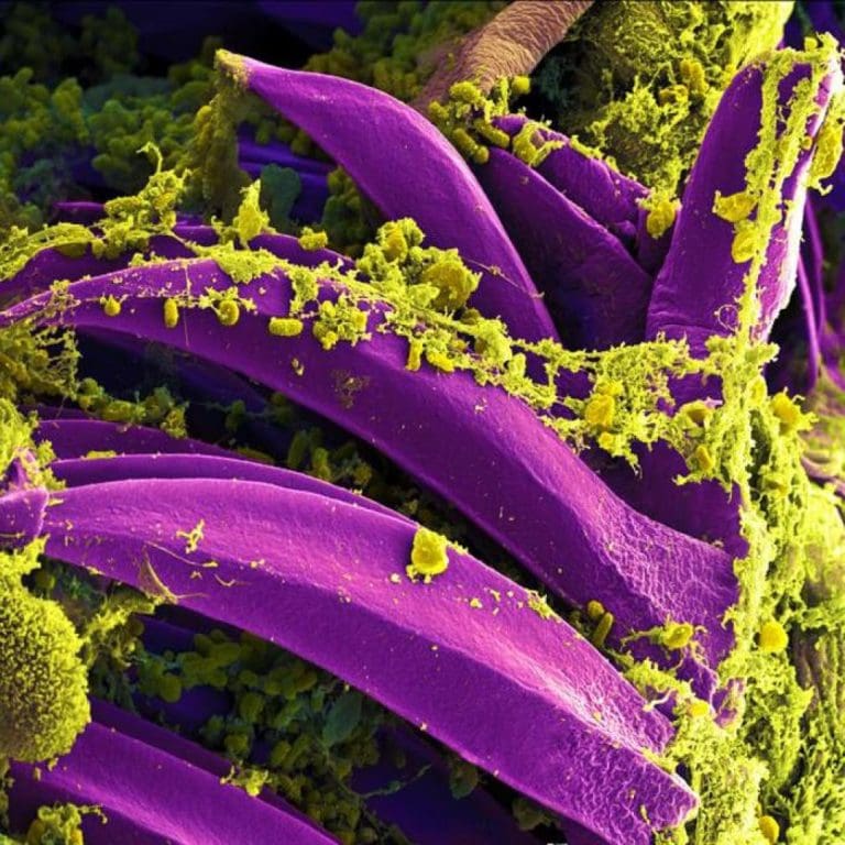 Yersinia pestis bacteria under microscope — the germ that causes plague
