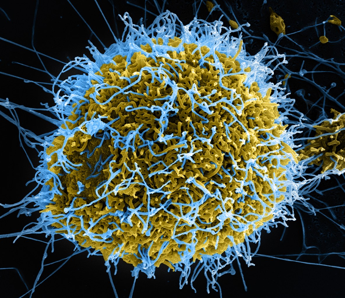 Colourised electron micrograph of Ebola virus particles budding from an infected cell, illustrating the Regeneron Ebola treatment deal