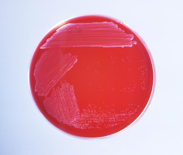 Blood agar plate showing bacterial growth after incubation