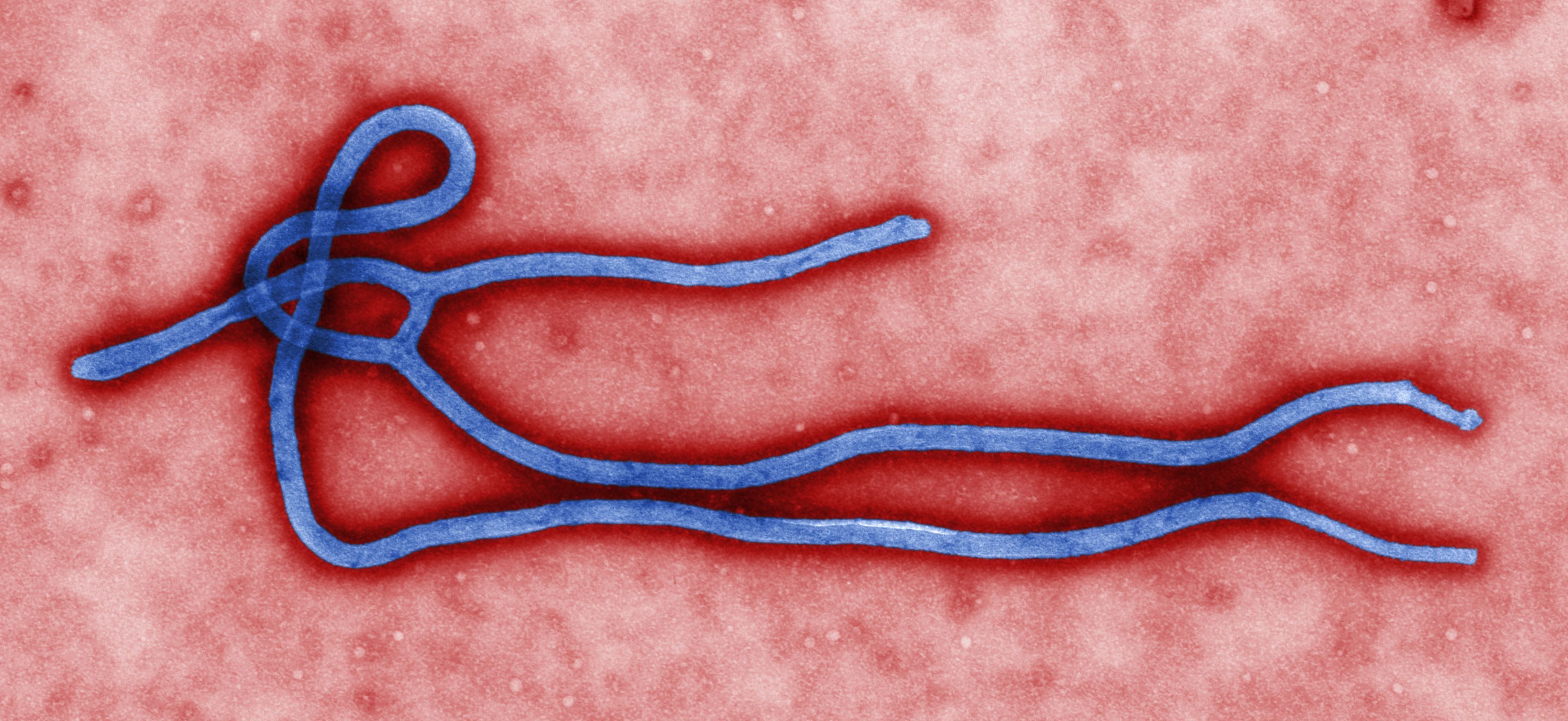 Colorized electron micrograph of an Ebola virus virion