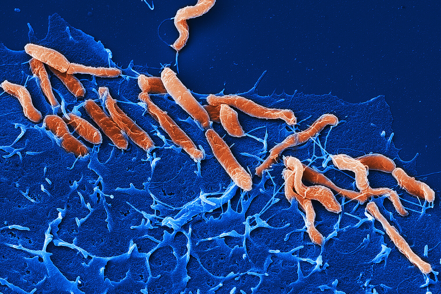 Colorized micrograph of H. pylori bacteria associated with stomach cancer
