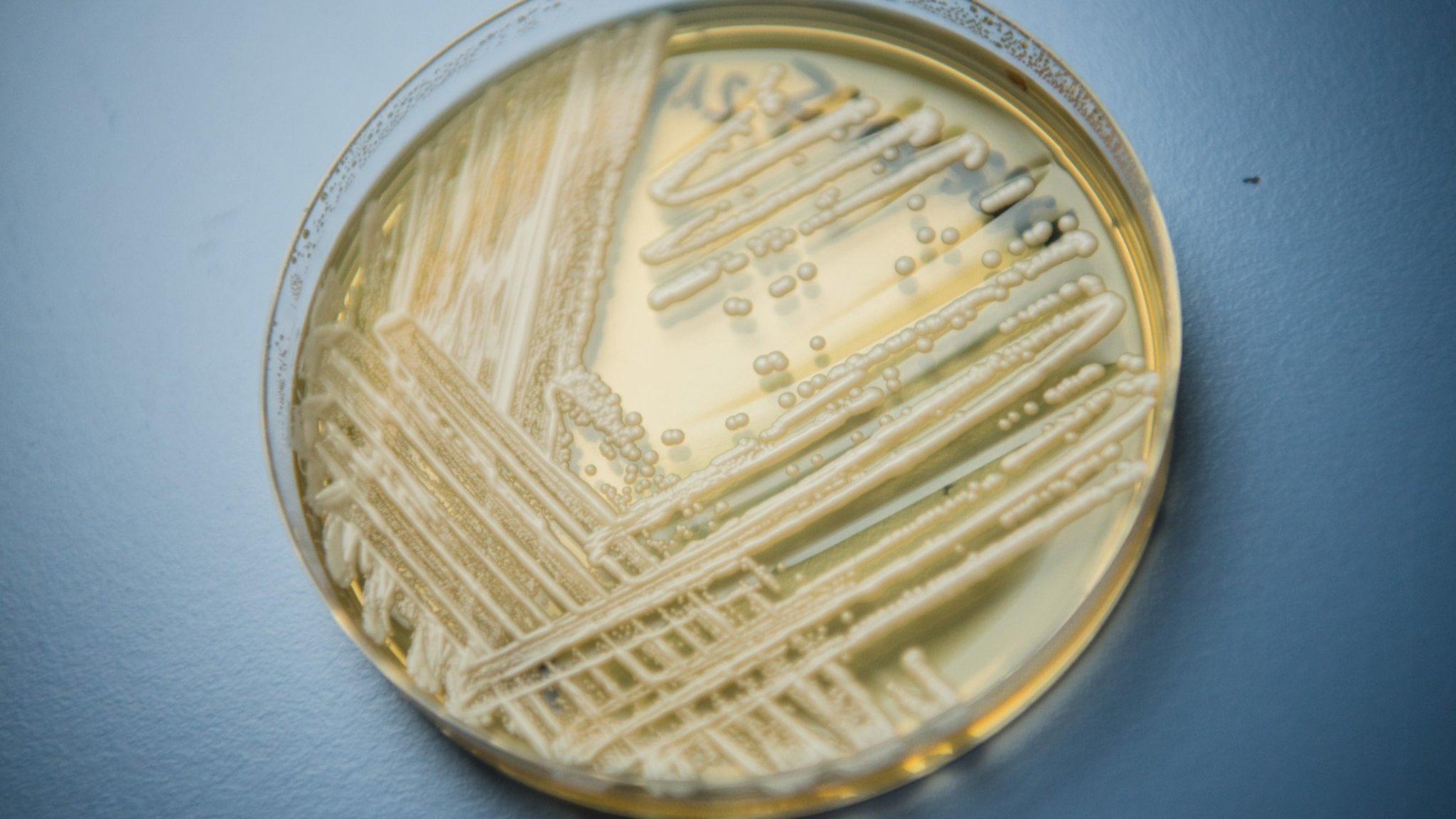 Candida auris colonies growing on an agar culture plate — the drug-resistant fungus at the top of the CDC drug-resistant germs report&rsquo;s urgent-threat list