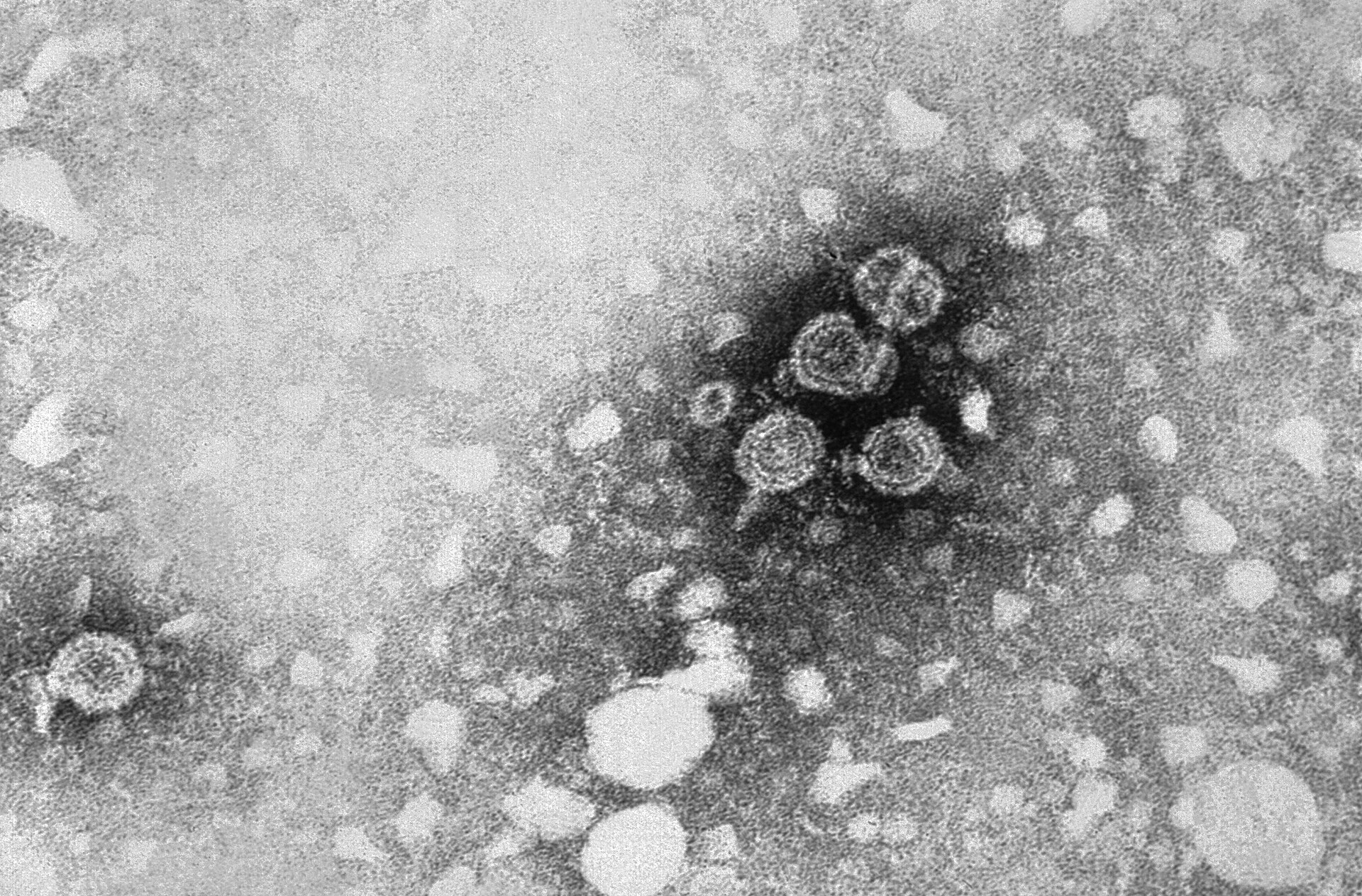 Hepatitis B functional cure drug — electron micrograph of hepatitis B virions, the virus Hibsago targets