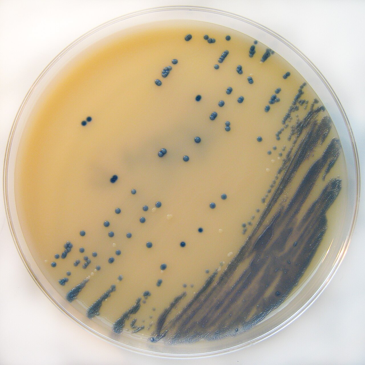 Dark MRSA colonies growing on a chromogenic agar plate in a microbiology laboratory — MRSA is among the drug-resistant threats tracked in the CDC drug-resistant germs report