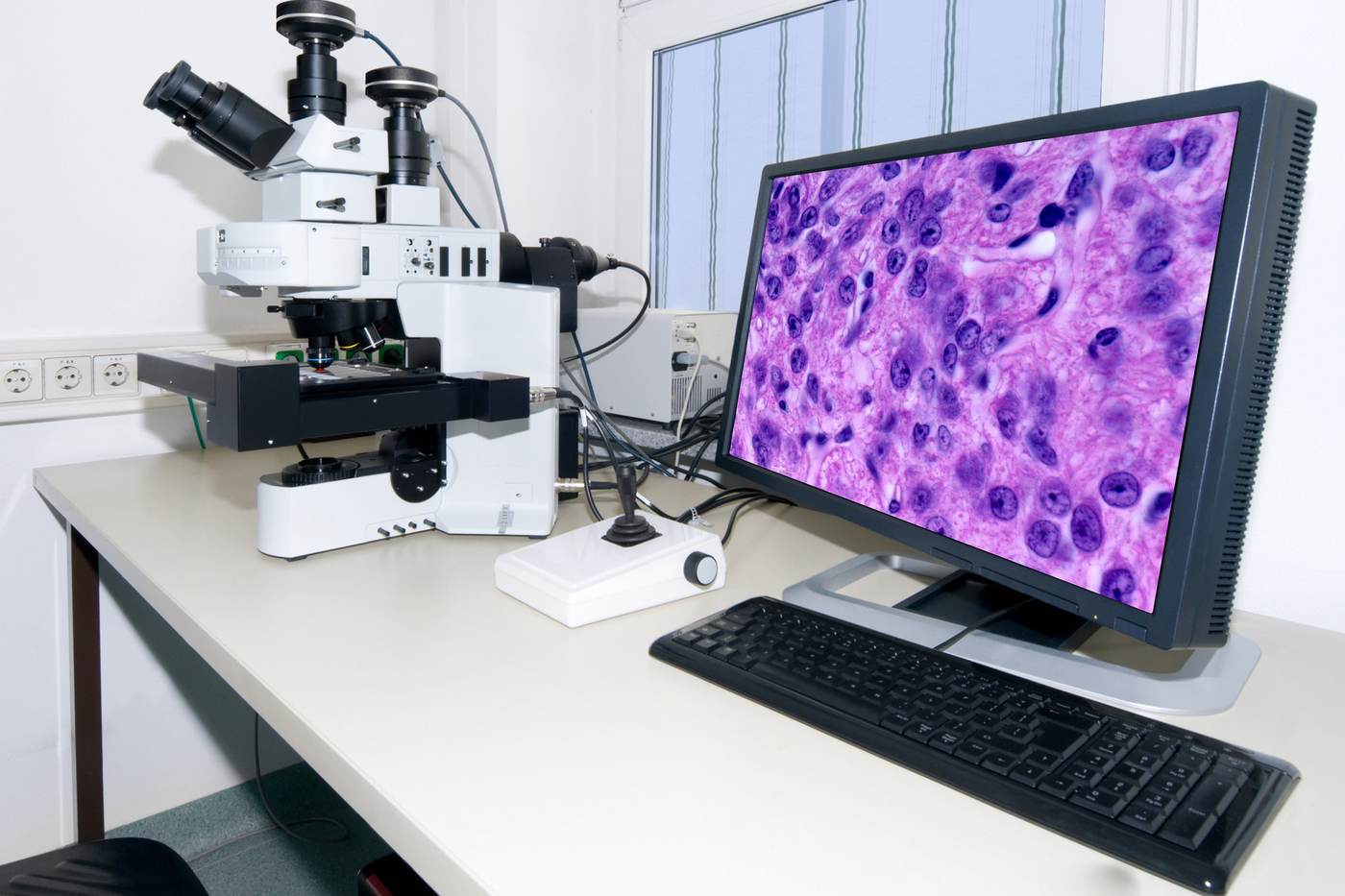 Cancer researchers working in a laboratory, illustrating individualized neoantigen therapy development