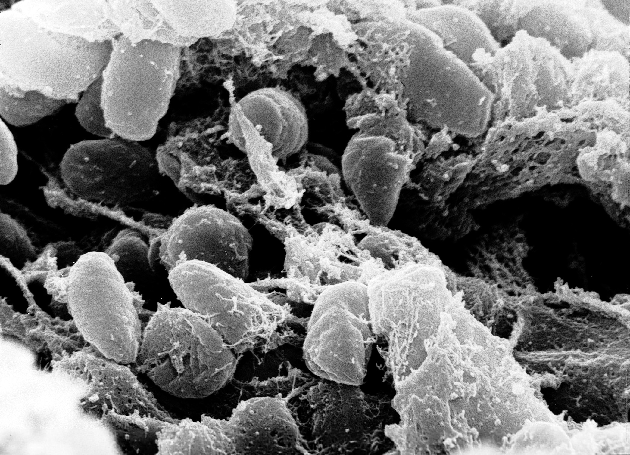 Scanning electron micrograph of Yersinia pestis bacteria that cause pneumonic plague symptoms