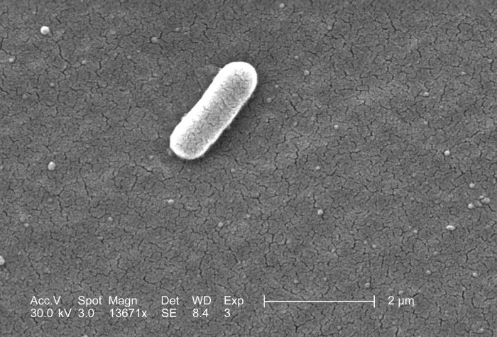 Yersinia pestis bacteria under magnification in the Russia plague death investigation