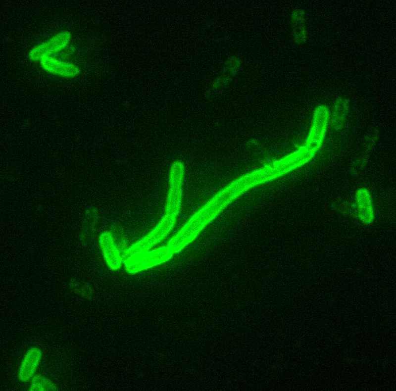 Yersinia pestis bacteria under direct fluorescent antibody stain in the Irkutsk plague lab worker death case
