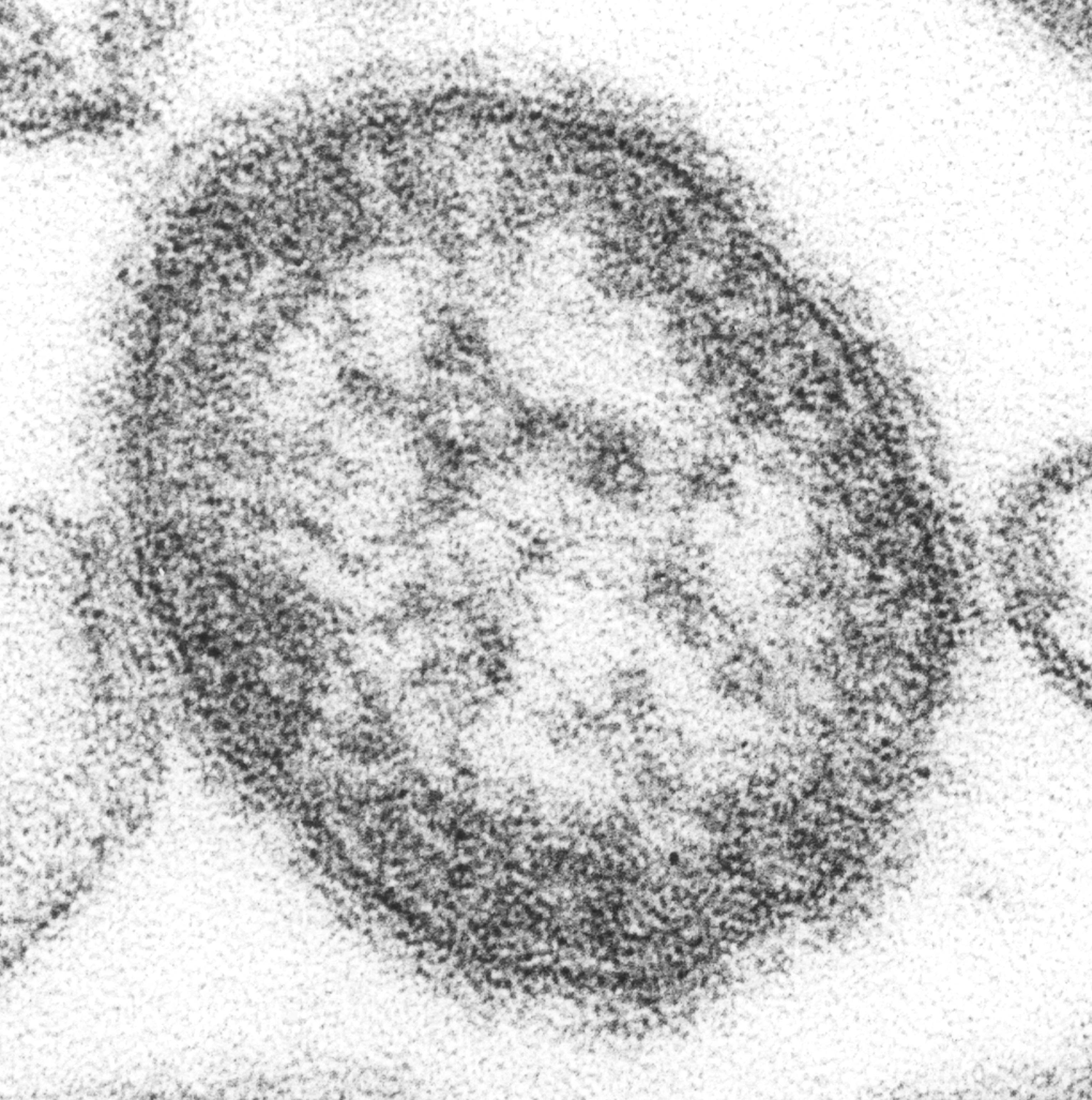 Transmission electron micrograph of the measles virus, one of the most contagious known pathogens