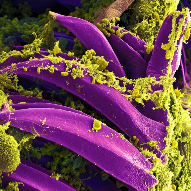 Colorized CDC micrograph of Yersinia pestis bacteria, the organism that causes plague