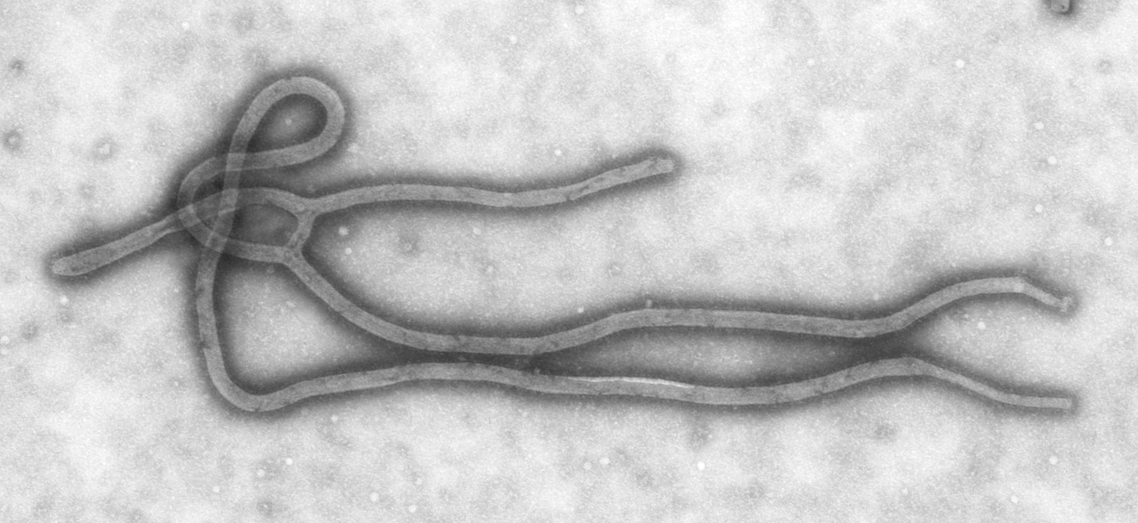 Electron microscope image of Ebola virus particles — Kenya confirmed its first Ebola case, the Bundibugyo strain