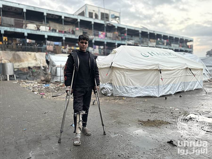 A displaced child with a leg injury in Jabalia refugee camp in February 2025 — file photo illustrating risks facing displaced families in northern Gaza