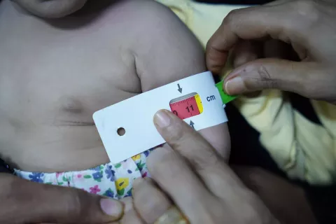 Yemen humanitarian crisis: UNICEF mobile teams screen children for malnutrition as fighting displaces families.